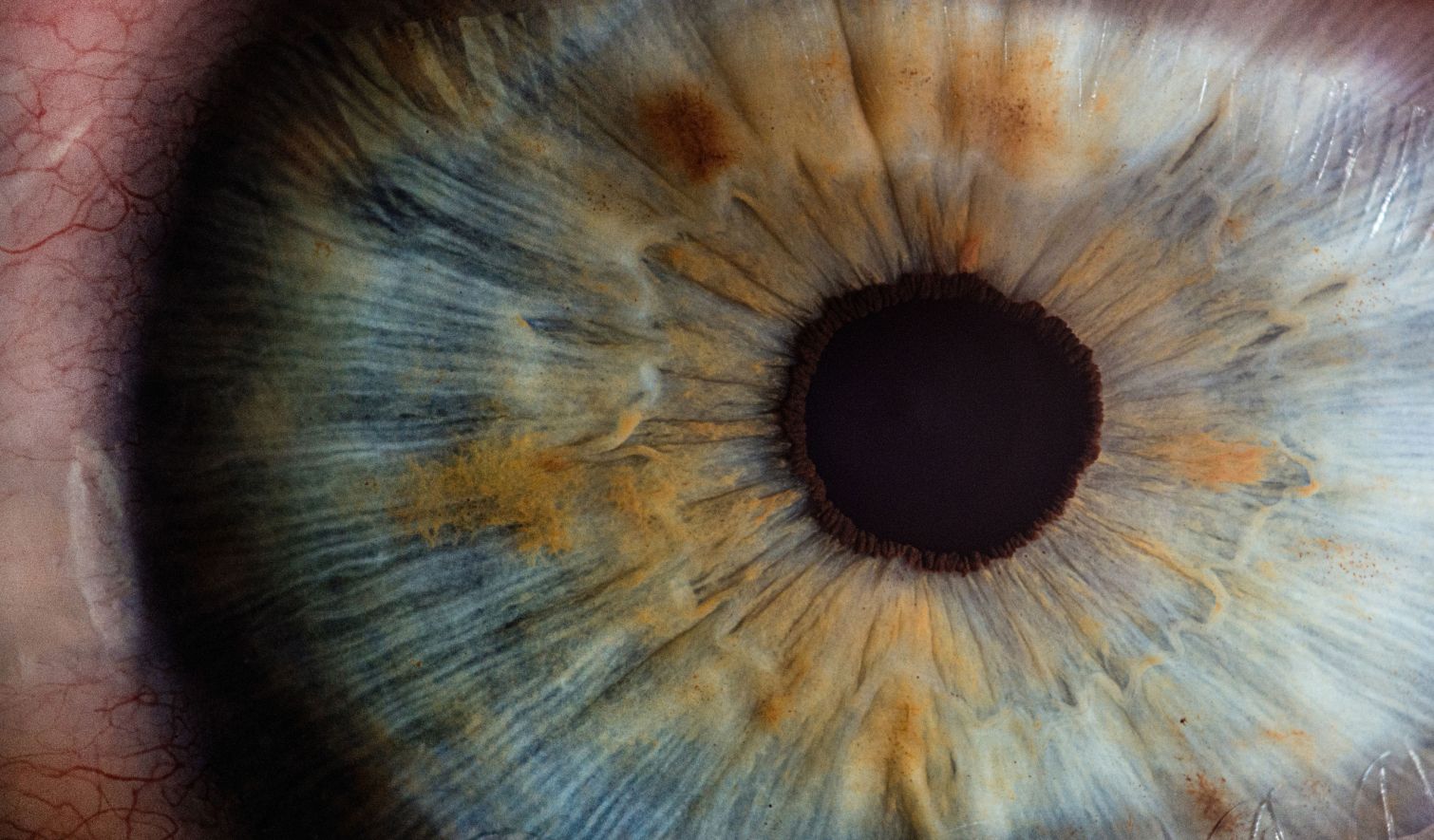 Αισθητική Οφθαλμολογία